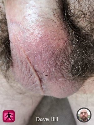 close_up — Dave Hill