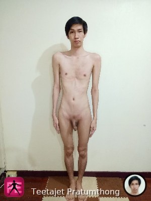 frontal — Teetajet Pratumthong